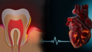 Root Canal And Heart: क्या दांतों के रूट कैनाल ट्रीटमेंट से दिल का दौरा पड़ सकता है, जानिए इसमें कितनी सच्चाई है?